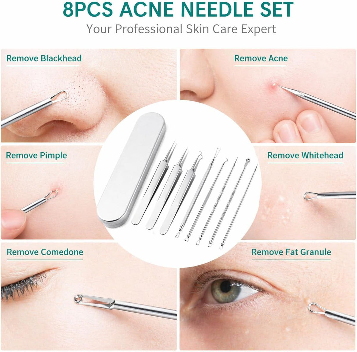 Kit de 8 Piezas para Extracción de Puntos Negros